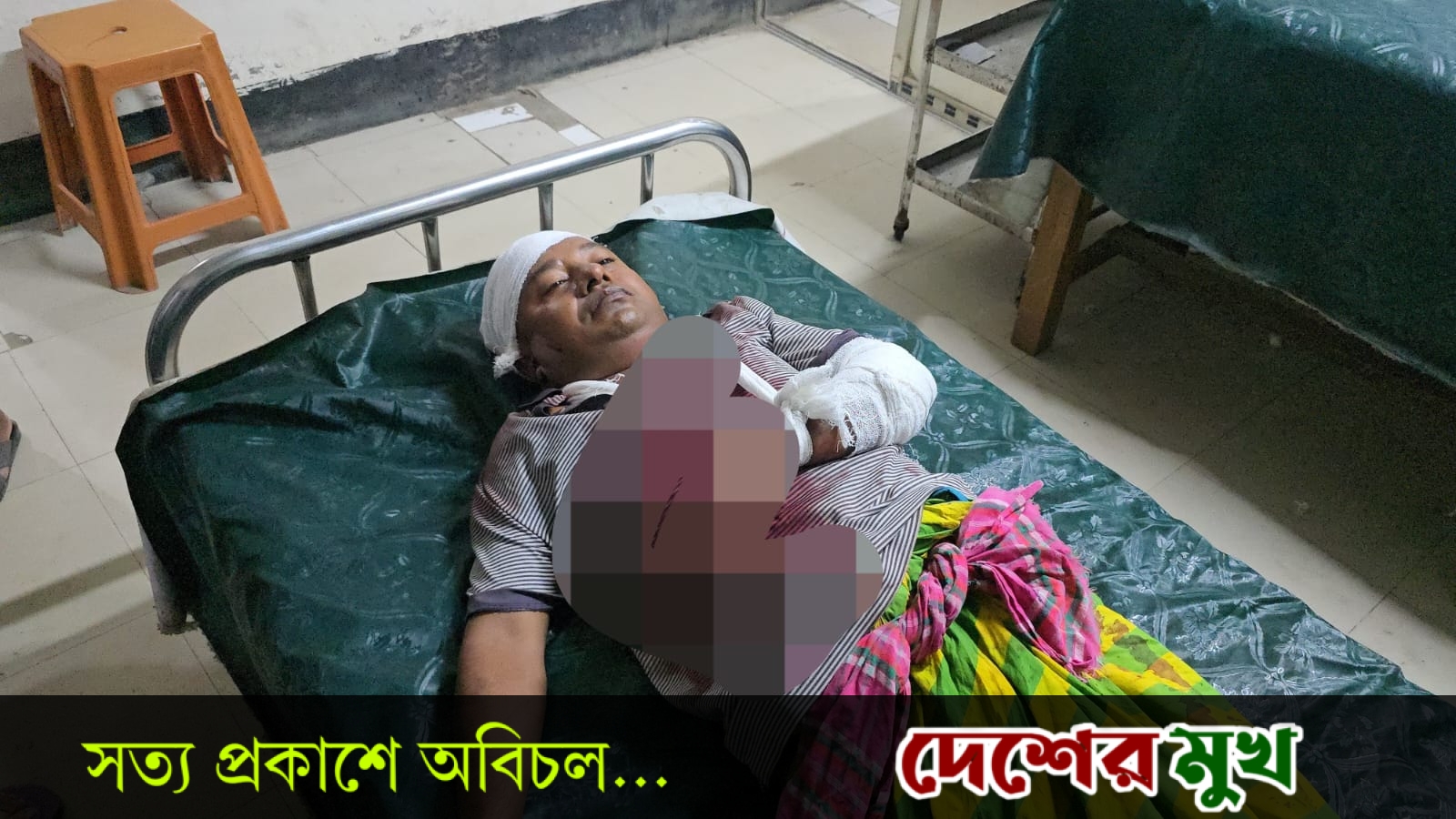 রূপগঞ্জে বিএনপি নেতাকে কুপিয়ে আহত আধিপত্য বিস্তারকে কেন্দ্র করে ফের উত্তপ্ত কাঞ্চনের বিরাব এলাকা