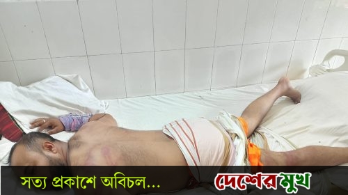 রূপগঞ্জে সাংবাদিকের ওপর হামলার ঘটনায় মামলা; প্রকাশ্যে ঘুরে বেড়াচ্ছে আসামিরা