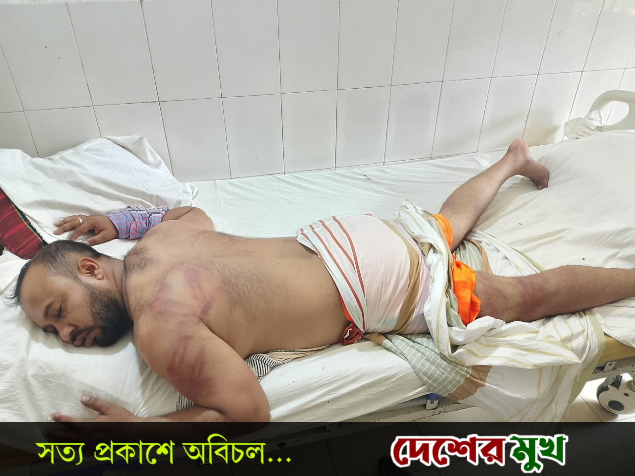 রূপগঞ্জে সাংবাদিকের ওপর হামলার ঘটনায় মামলা; প্রকাশ্যে ঘুরে বেড়াচ্ছে আসামিরা